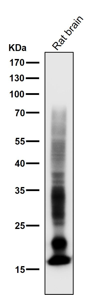 Anti-Myelin Basic Protein MBP Rabbit Monoclonal Antibody Boster Bio