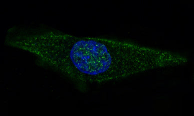 Anti-GFAP Rabbit Monoclonal Antibody Boster Bio