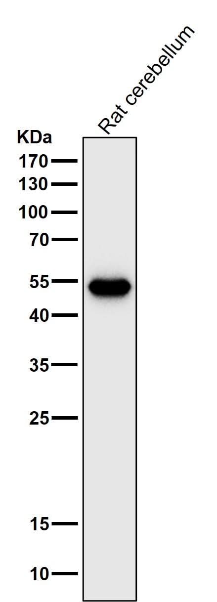 Anti-GFAP Rabbit Monoclonal Antibody Boster Bio