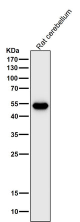 Anti-GFAP Rabbit Monoclonal Antibody Boster Bio