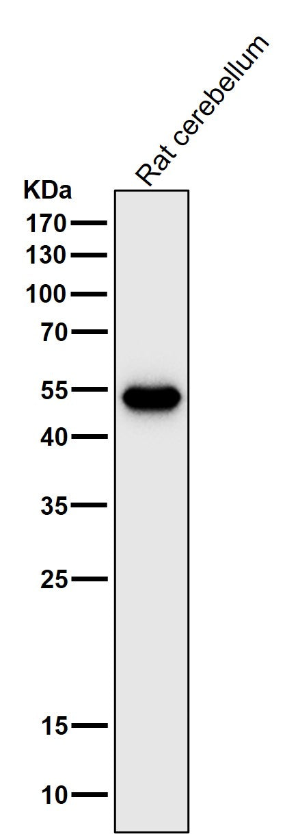 Anti-GFAP Rabbit Monoclonal Antibody Boster Bio