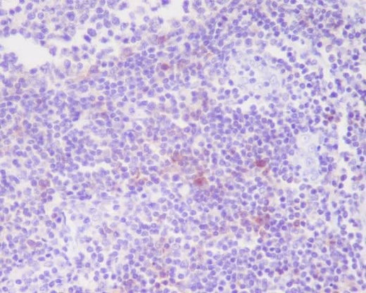 Anti-CD25 IL2RA Monoclonal Antibody Boster Bio