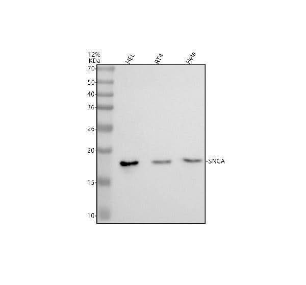 Anti-Alpha Synuclein SNCA Rabbit Monoclonal Antibody Boster Bio