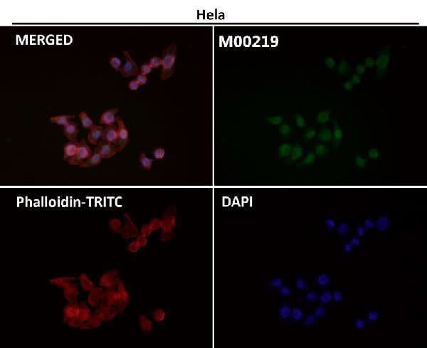 Anti-FTO Monoclonal Antibody Boster Bio