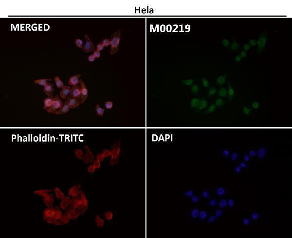 Anti-FTO Monoclonal Antibody Boster Bio