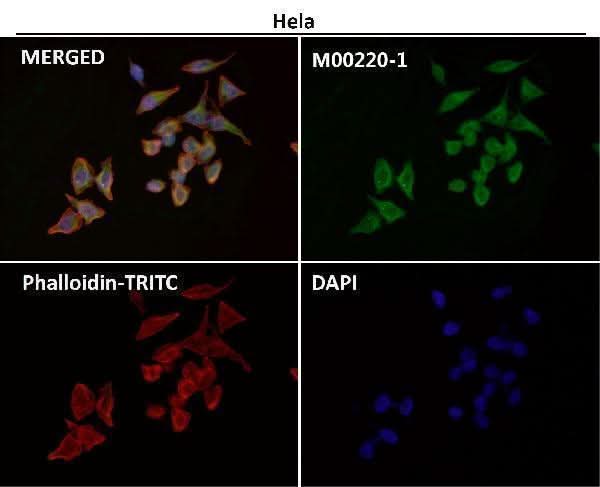 Anti-CD86/B7 2 Rabbit Monoclonal Antibody Boster Bio