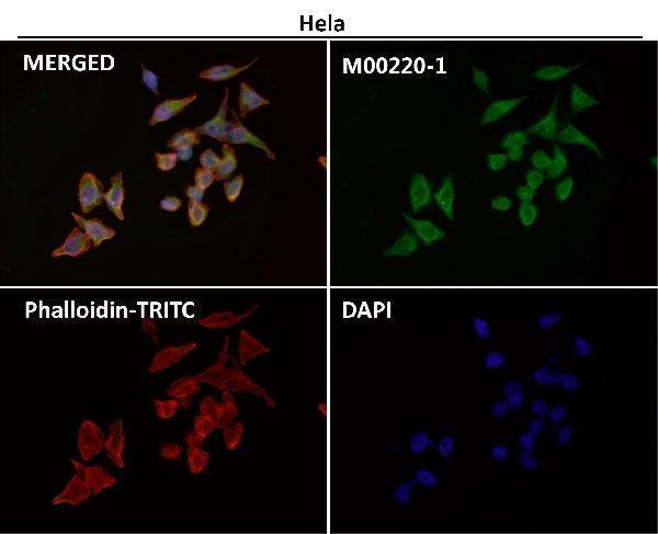 Anti-CD86/B7 2 Rabbit Monoclonal Antibody Boster Bio