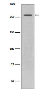 Anti-LRRK2 Rabbit Monoclonal Antibody Boster Bio