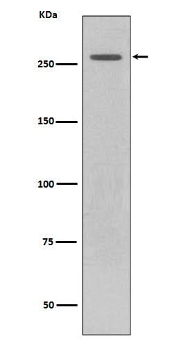 Anti-LRRK2 Rabbit Monoclonal Antibody Boster Bio