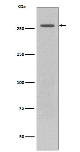 Anti-LRRK2 Rabbit Monoclonal Antibody Boster Bio