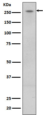 Anti-LRRK2 Rabbit Monoclonal Antibody Boster Bio
