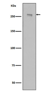 Anti-LRRK2 Rabbit Monoclonal Antibody Boster Bio