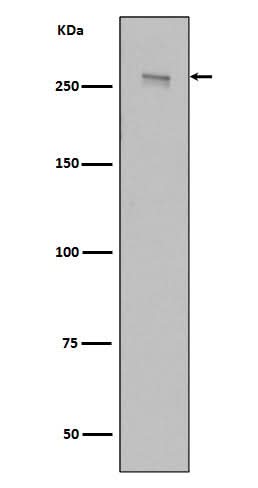Anti-LRRK2 Rabbit Monoclonal Antibody Boster Bio