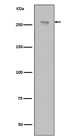 Anti-LRRK2 Rabbit Monoclonal Antibody Boster Bio