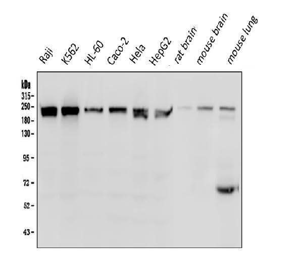 Anti-BRG1 SMARCA4 Antibody Picoband® (monoclonal, 3F4 Boster Bio