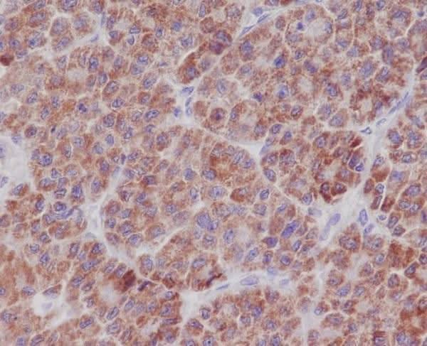 Anti-TNFAIP3/A20 Rabbit Monoclonal Antibody Boster Bio
