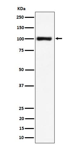 Anti-Nucleolin Rabbit Monoclonal Antibody Boster Bio