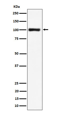Anti-Nucleolin Rabbit Monoclonal Antibody Boster Bio