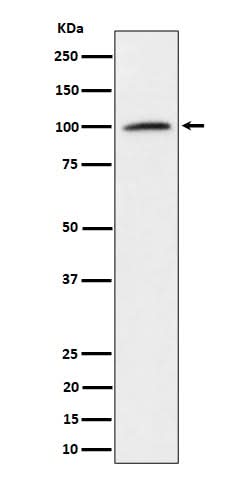 Anti-Nucleolin Rabbit Monoclonal Antibody Boster Bio