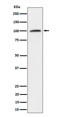 Anti-Nucleolin Rabbit Monoclonal Antibody Boster Bio