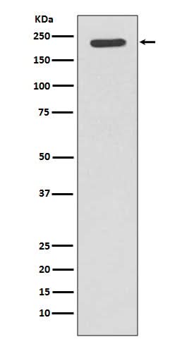 Anti-Tuberin TSC2 Rabbit Monoclonal Antibody Boster Bio