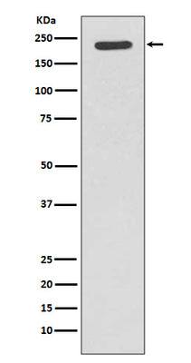 Anti-Tuberin TSC2 Rabbit Monoclonal Antibody Boster Bio