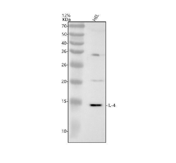 Anti-IL4 Rabbit Monoclonal Antibody Boster Bio