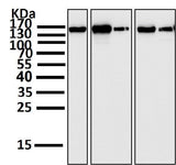 Anti-FGFR2 Rabbit Monoclonal Antibody Boster Bio