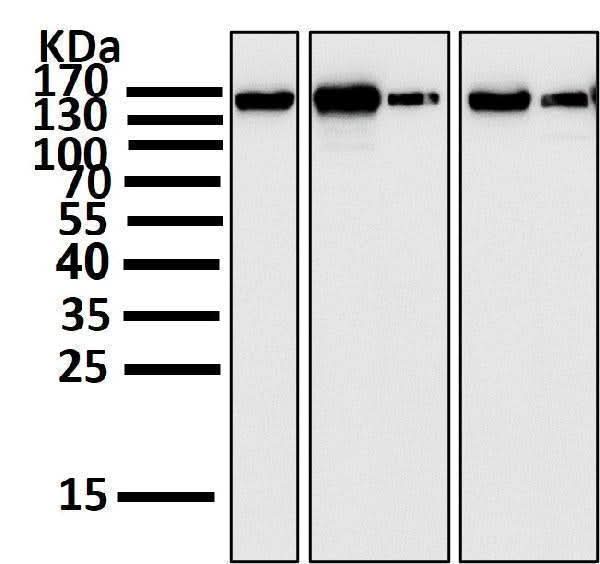 Anti-FGFR2 Rabbit Monoclonal Antibody Boster Bio