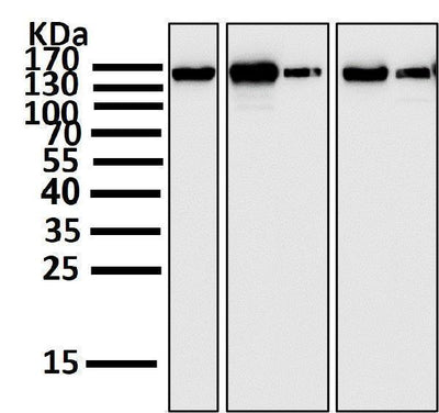 Anti-FGFR2 Rabbit Monoclonal Antibody Boster Bio