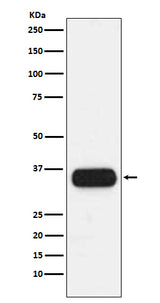 Anti-HLA-DQA1 Monoclonal Antibody Boster Bio