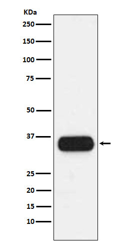 Anti-HLA-DQA1 Monoclonal Antibody Boster Bio
