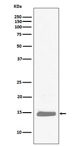 Anti-Hemoglobin subunit alpha HBA1 Rabbit Monoclonal Antibody Boster Bio