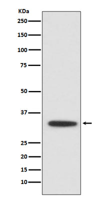 Anti-XBP1 Rabbit Monoclonal Antibody Boster Bio