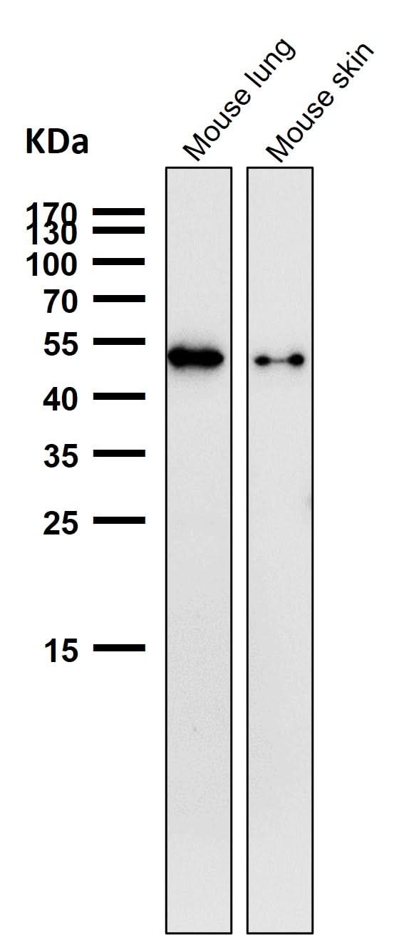 Anti-Phospho-Vimentin (S39) Rabbit Monoclonal Antibody Boster Bio