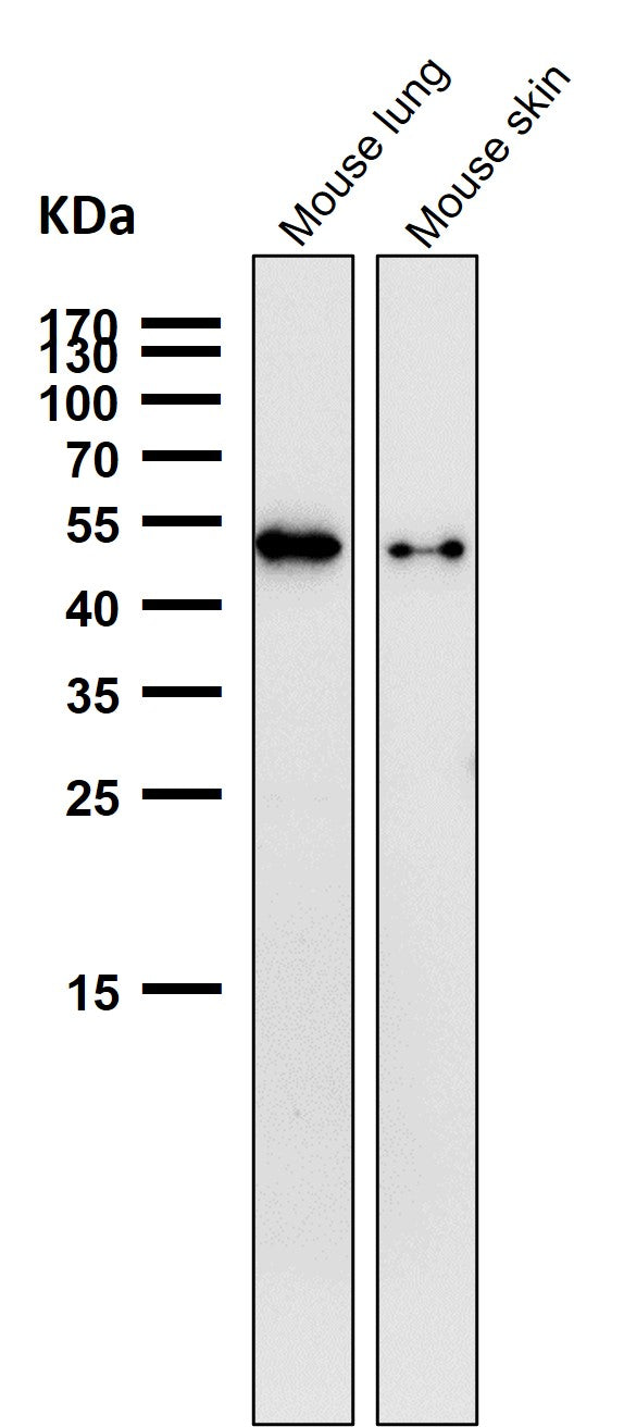Anti-Phospho-Vimentin (S39) Rabbit Monoclonal Antibody Boster Bio
