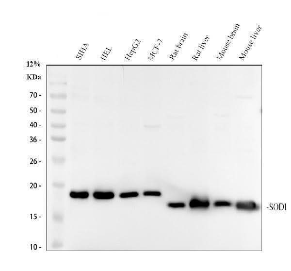 Anti-SOD1/Cu Zn Sod Rabbit Monoclonal Antibody Boster Bio
