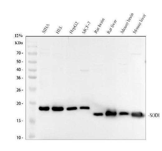 Anti-SOD1/Cu Zn Sod Rabbit Monoclonal Antibody Boster Bio