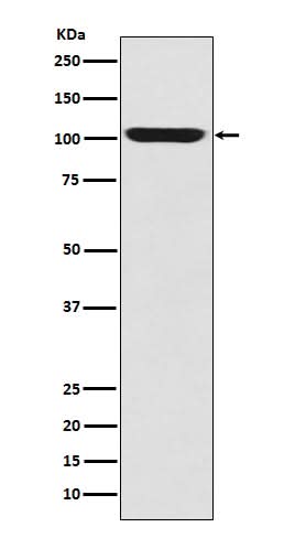 Anti-LGR5/GPR49 Rabbit Monoclonal Antibody Boster Bio