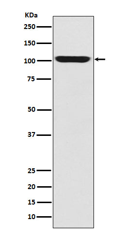 Anti-LGR5/GPR49 Rabbit Monoclonal Antibody Boster Bio