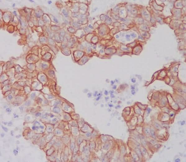 Anti-ATG5/Apg5 Rabbit Monoclonal Antibody Boster Bio