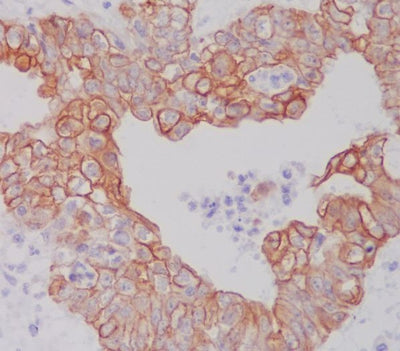 Anti-ATG5/Apg5 Rabbit Monoclonal Antibody Boster Bio