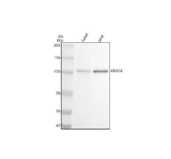 Anti-DDX58 Monoclonal Antibody Boster Bio