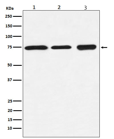 Anti-BTK Rabbit Monoclonal Antibody Boster Bio