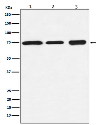 Anti-BTK Rabbit Monoclonal Antibody Boster Bio