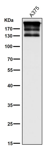Anti-ARID1A Rabbit Monoclonal Antibody Boster Bio