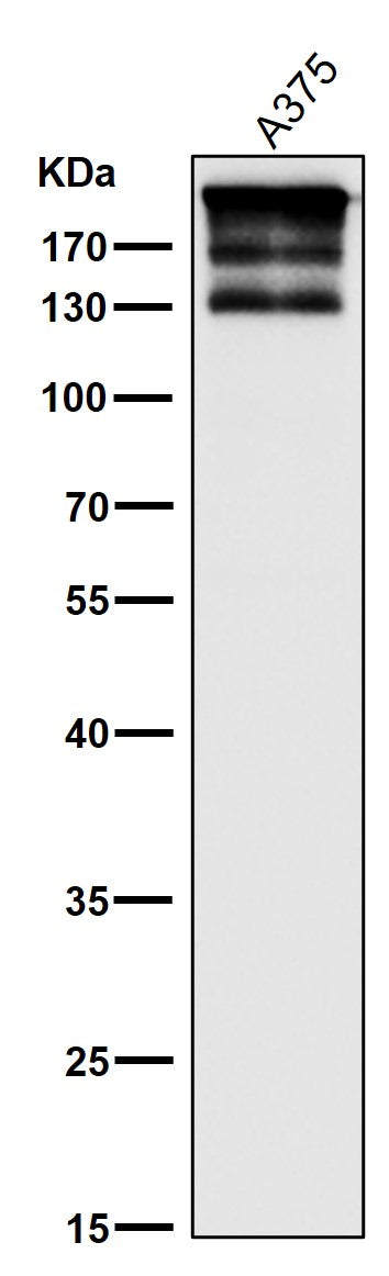 Anti-ARID1A Rabbit Monoclonal Antibody Boster Bio