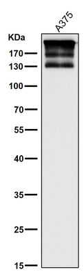 Anti-ARID1A Rabbit Monoclonal Antibody Boster Bio