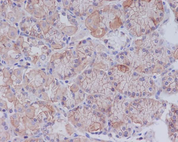 Anti-CD147 BSG Rabbit Monoclonal Antibody Boster Bio