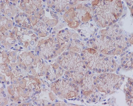 Anti-CD147 BSG Rabbit Monoclonal Antibody Boster Bio